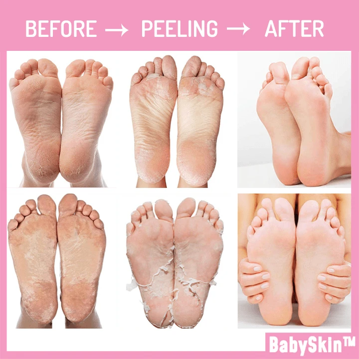 baby foot peel ebay
